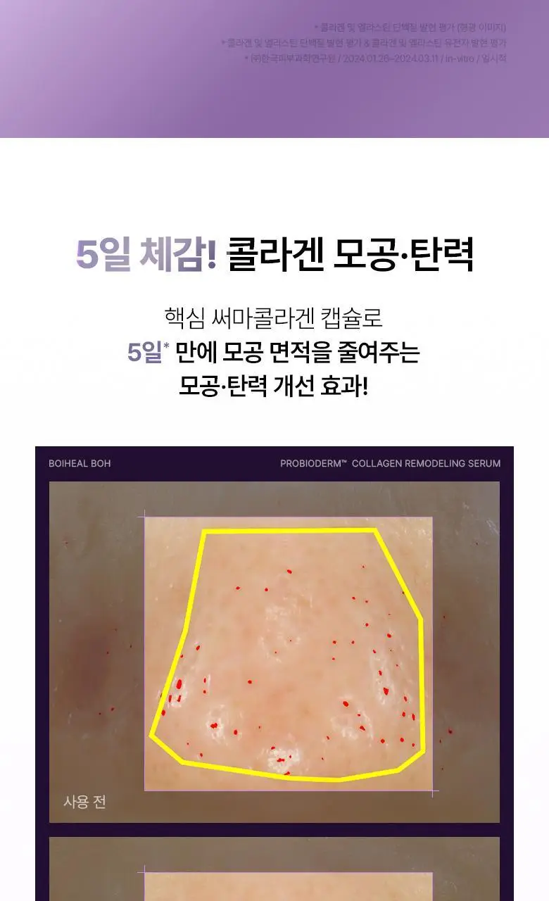 [기프트세트] 바이오힐보 프로바이오덤 콜라겐 리모델링 스킨케어 3종 기획 상세페이지 17